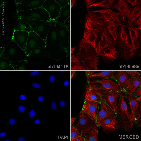 Immunocytochemistry/ Immunofluorescence - Alexa Fluor® 488 Anti-beta Catenin antibody [E247] (AB194118)