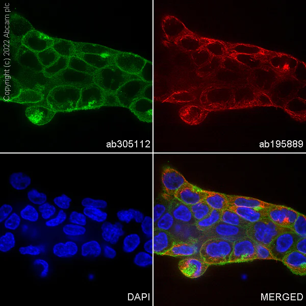 Immunocytochemistry/ Immunofluorescence - Alexa Fluor® 488 Anti-beta Catenin antibody [EP690Y] (AB305112)