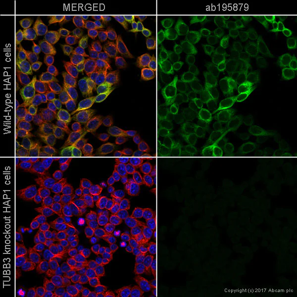 Immunocytochemistry/ Immunofluorescence - Alexa Fluor® 488 Anti-beta III Tubulin antibody [2G10] - Neuronal Marker (AB195879)