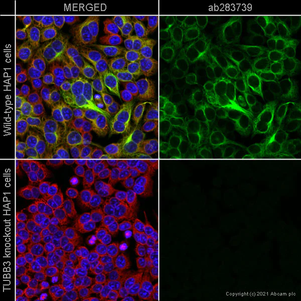 Immunocytochemistry/ Immunofluorescence - Alexa Fluor® 488 Anti-beta III Tubulin antibody [EPR1568Y] - Neuronal Marker (AB283739)