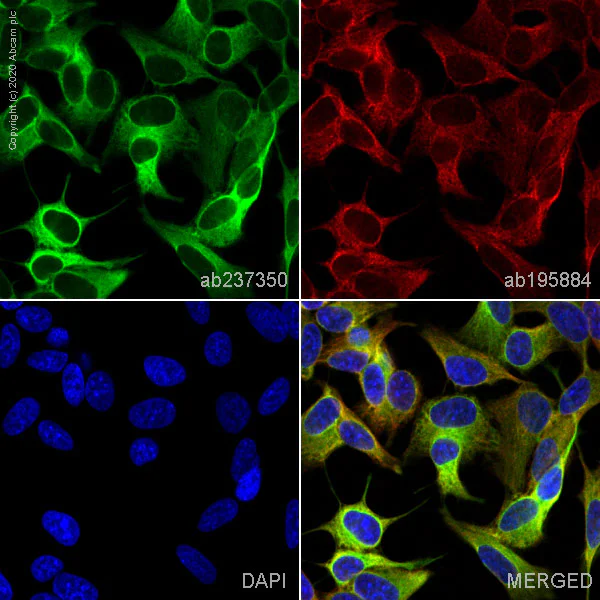 Immunocytochemistry/ Immunofluorescence - Alexa Fluor® 488 Anti-beta III Tubulin antibody [EPR19591] - Neuronal Marker (AB237350)