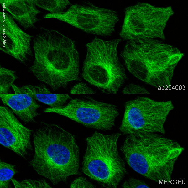 Anti-beta IV Tubulin Alexa Fluor® 488 antibody [EPR16775