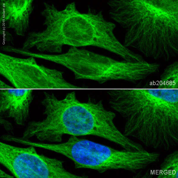 Immunocytochemistry/ Immunofluorescence - Alexa Fluor® 488 Anti-beta Tubulin antibody [EPR16774] - Microtubule Marker (AB204685)