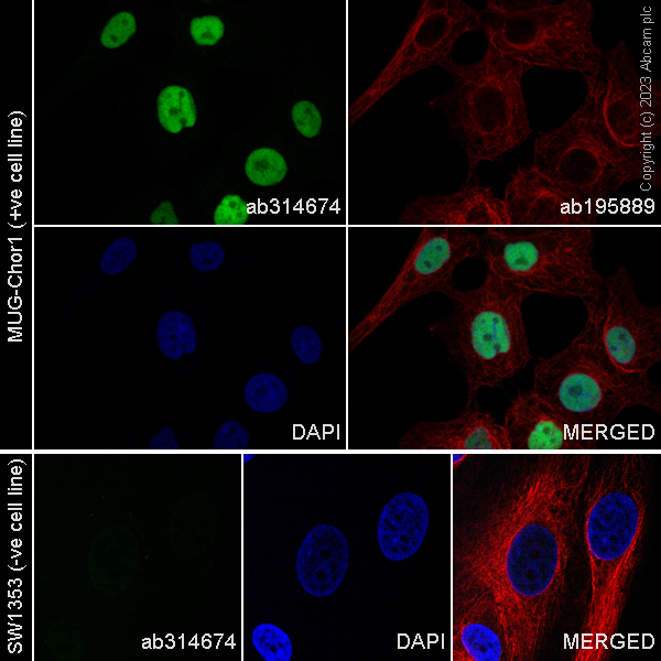Immunocytochemistry/ Immunofluorescence - Alexa Fluor® 488 Anti-Brachyury / Bry antibody [EPR18113] (AB314674)