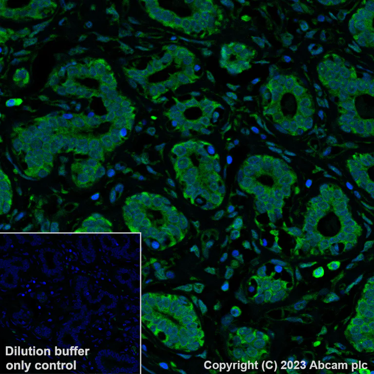 Immunohistochemistry (Formalin/PFA-fixed paraffin-embedded sections) - Alexa Fluor® 488 Anti-BRAF antibody [EP152Y] (AB309244)