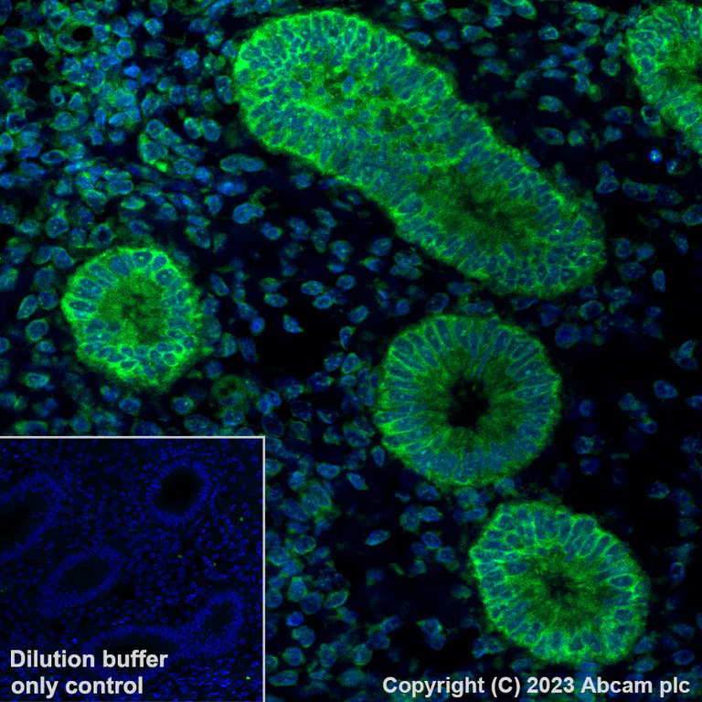 Immunohistochemistry (Formalin/PFA-fixed paraffin-embedded sections) - Alexa Fluor® 488 Anti-BRAF antibody [EP152Y] (AB309244)