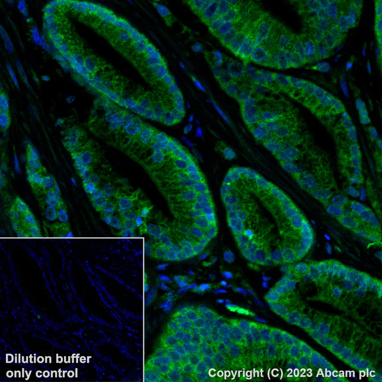 Immunohistochemistry (Formalin/PFA-fixed paraffin-embedded sections) - Alexa Fluor® 488 Anti-BRAF antibody [EP152Y] (AB309244)
