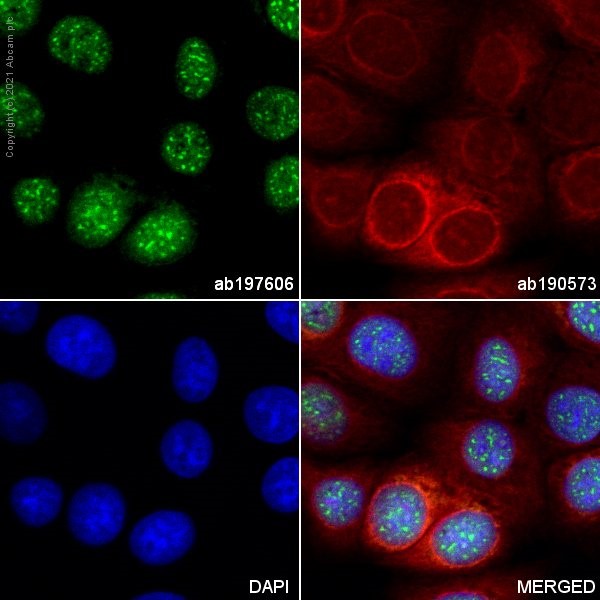 Immunocytochemistry - Alexa Fluor® 488 Anti-Brd4 antibody [EPR5150(2)] (AB197606), expandable thumbnail