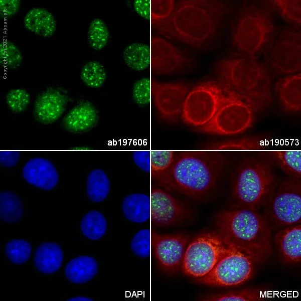 Immunocytochemistry - Alexa Fluor® 488 Anti-Brd4 antibody [EPR5150(2)] (AB197606)