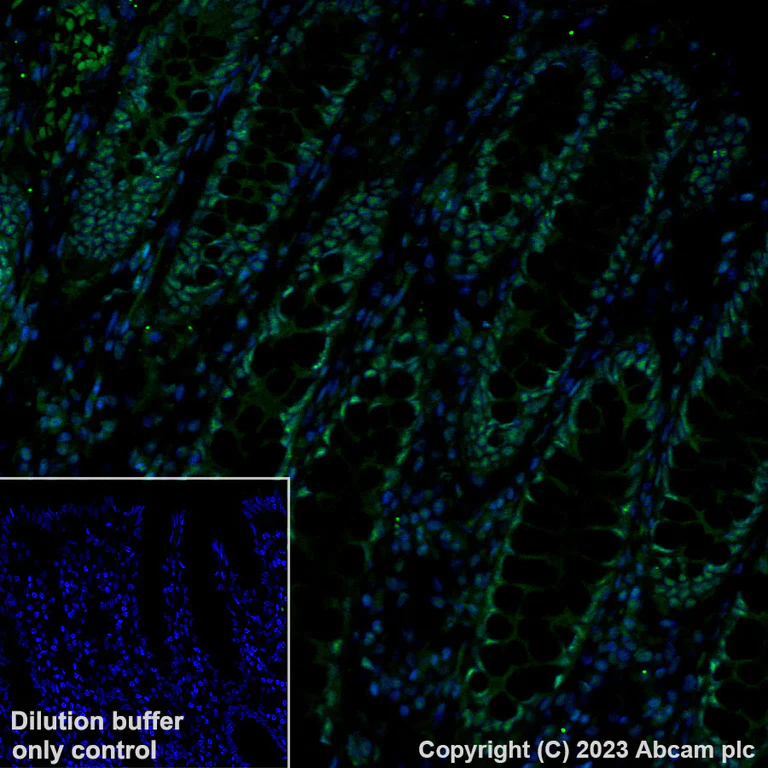 Immunohistochemistry (Formalin/PFA-fixed paraffin-embedded sections) - Alexa Fluor® 488 Anti-Brd4 antibody [EPR5150(2)] (AB197606)