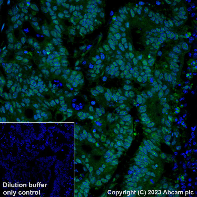 Immunohistochemistry (Formalin/PFA-fixed paraffin-embedded sections) - Alexa Fluor® 488 Anti-Brd4 antibody [EPR5150(2)] (AB197606)