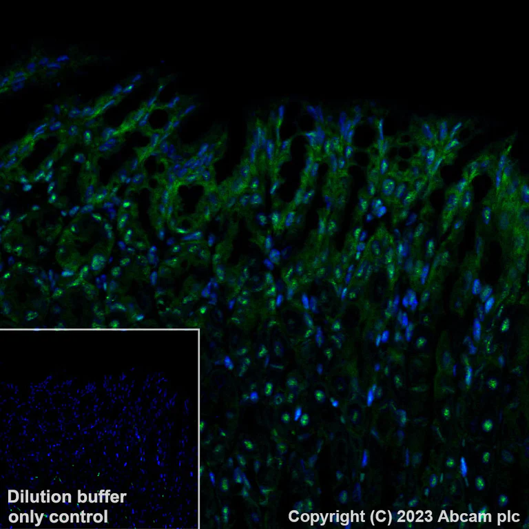 Immunohistochemistry (Formalin/PFA-fixed paraffin-embedded sections) - Alexa Fluor® 488 Anti-Brd4 antibody [EPR5150(2)] (AB197606)