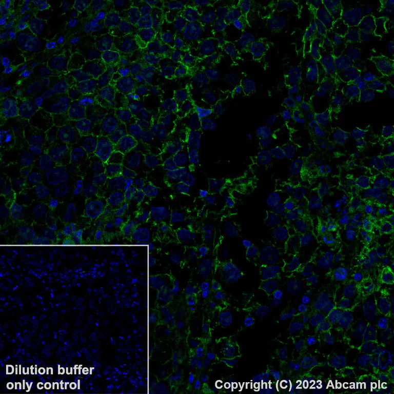 Immunohistochemistry (Formalin/PFA-fixed paraffin-embedded sections) - Alexa Fluor® 488 Anti-c-Kit antibody [YR145] (AB309968)