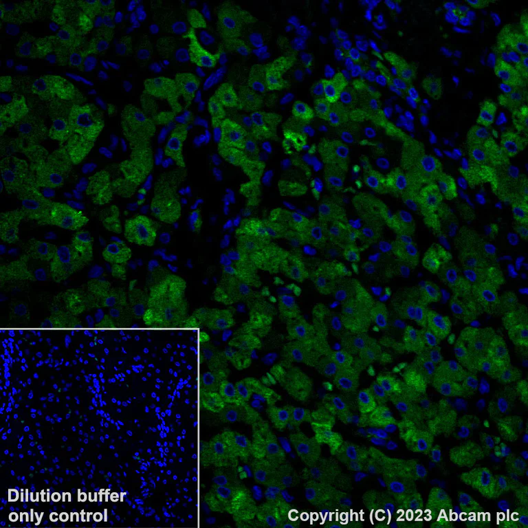 Immunohistochemistry (Formalin/PFA-fixed paraffin-embedded sections) - Alexa Fluor® 488 Anti-C Reactive Protein antibody [Y284] (AB314471)