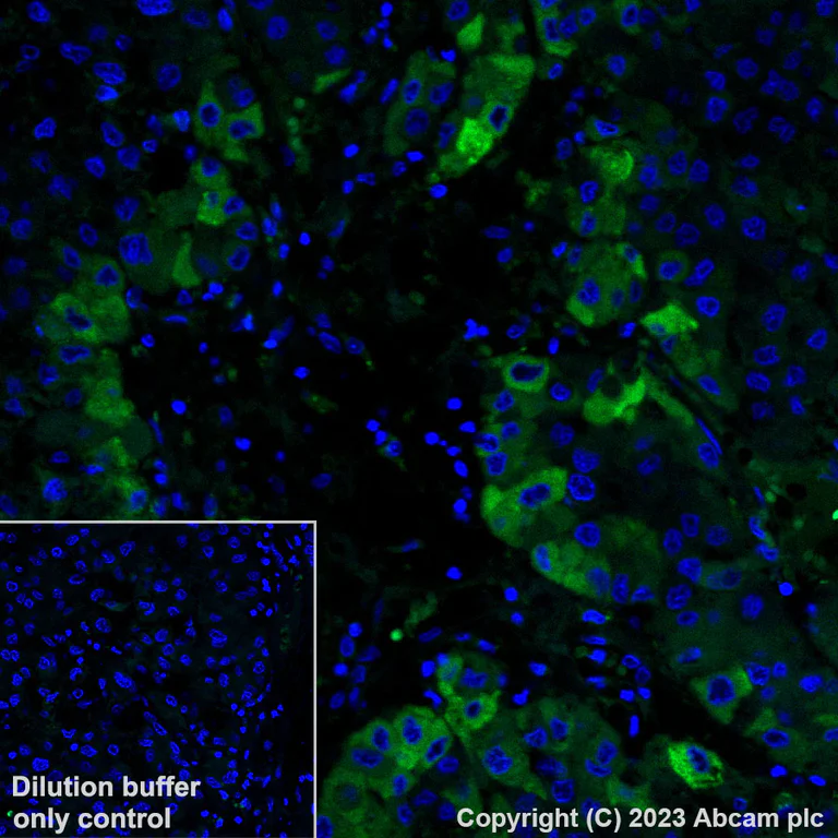 Immunohistochemistry (Formalin/PFA-fixed paraffin-embedded sections) - Alexa Fluor® 488 Anti-C Reactive Protein antibody [Y284] (AB314471)