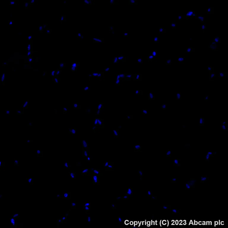 Immunohistochemistry (Formalin/PFA-fixed paraffin-embedded sections) - Alexa Fluor® 488 Anti-C Reactive Protein antibody [Y284] (AB314471)