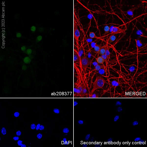 Immunocytochemistry/ Immunofluorescence - Alexa Fluor® 488 Anti-Calbindin antibody [EP3478] (AB208377)
