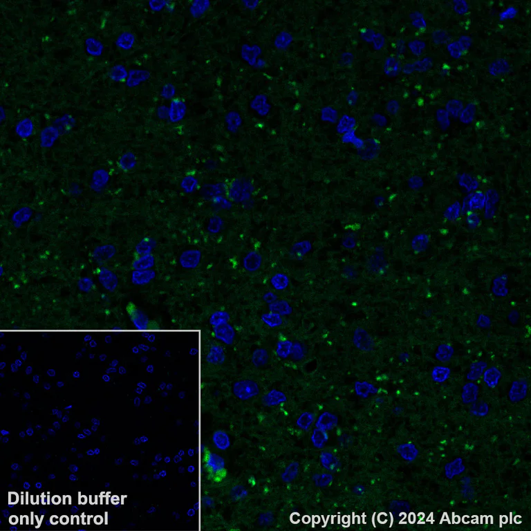 Immunohistochemistry (Formalin/PFA-fixed paraffin-embedded sections) - Alexa Fluor® 488 Anti-Calcineurin B/PPP3R1 antibody [EPR24992-18] (AB316339)