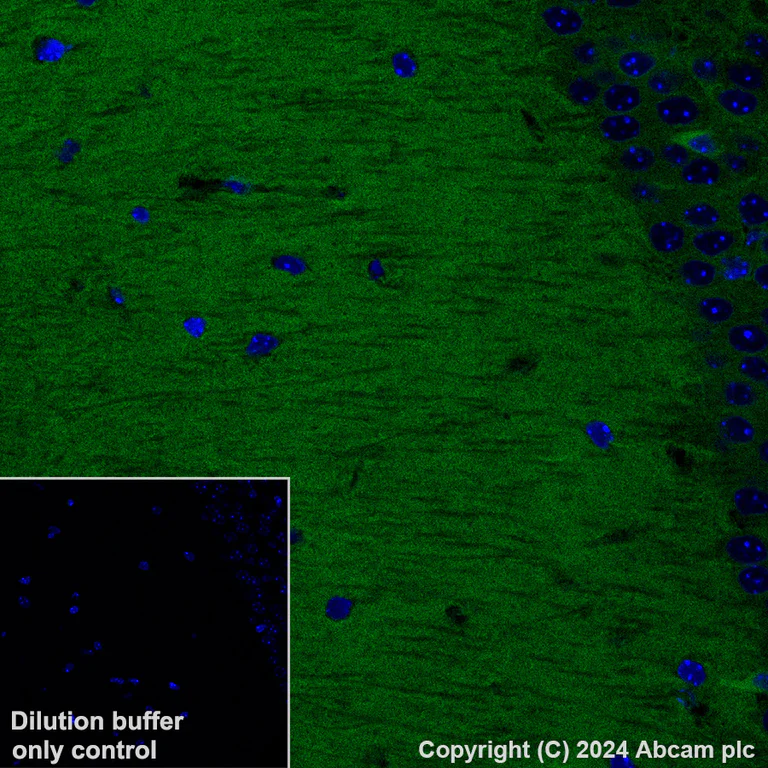 Immunohistochemistry (Formalin/PFA-fixed paraffin-embedded sections) - Alexa Fluor® 488 Anti-Calcineurin B/PPP3R1 antibody [EPR24992-18] (AB316339)
