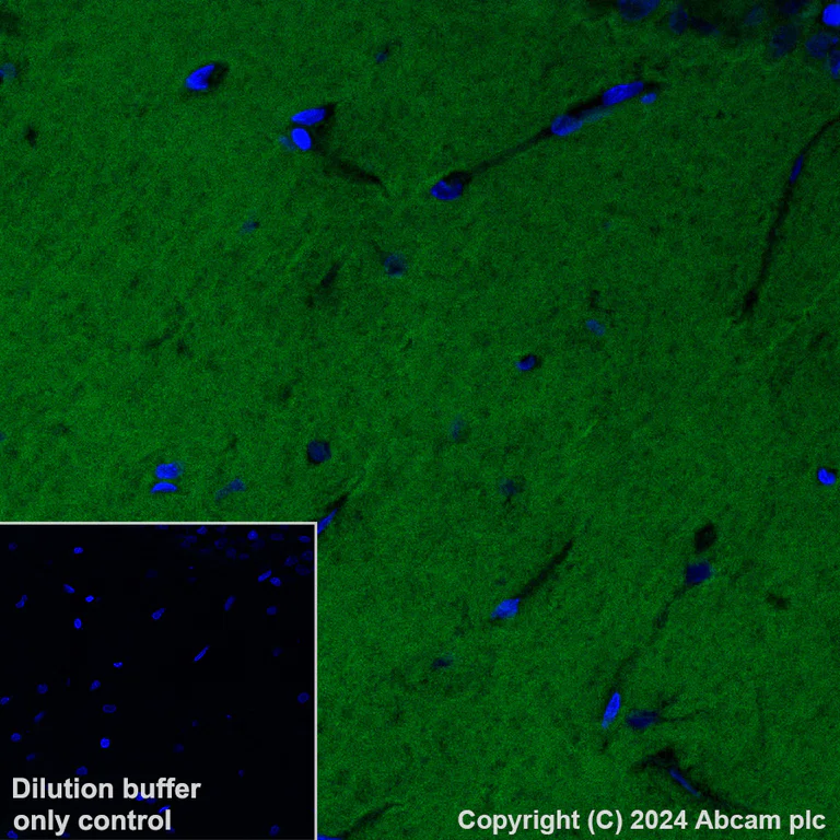 Immunohistochemistry (Formalin/PFA-fixed paraffin-embedded sections) - Alexa Fluor® 488 Anti-Calcineurin B/PPP3R1 antibody [EPR24992-18] (AB316339)