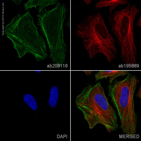 Immunocytochemistry/ Immunofluorescence - Alexa Fluor® 488 Anti-Caldesmon/CDM antibody [E89] (AB208116)