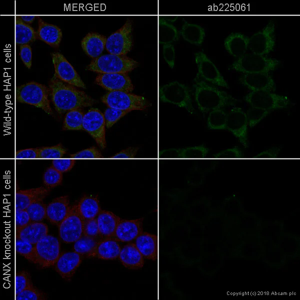 Immunocytochemistry/ Immunofluorescence - Alexa Fluor® 488 Anti-Calnexin antibody [EPR3632] (AB225061)