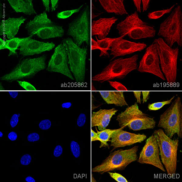 Immunocytochemistry/ Immunofluorescence - Alexa Fluor® 488 Anti-CaMKII antibody [EPR6686(2)] (AB205862)