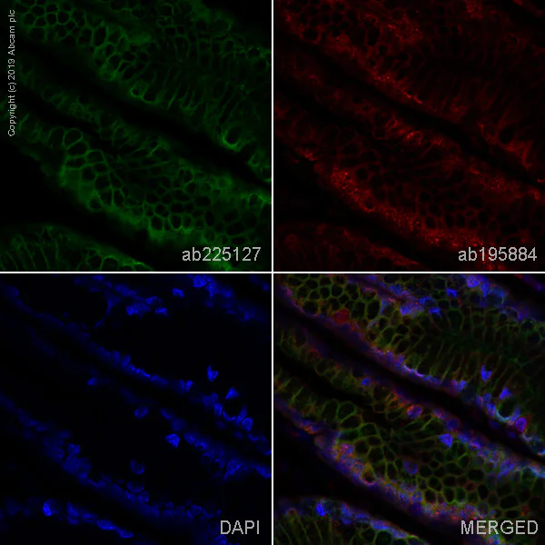 Immunohistochemistry (Formalin/PFA-fixed paraffin-embedded sections) - Alexa Fluor® 488 Anti-Carbonic anhydrase 2/CA2 antibody [EPR5195] (AB225127)