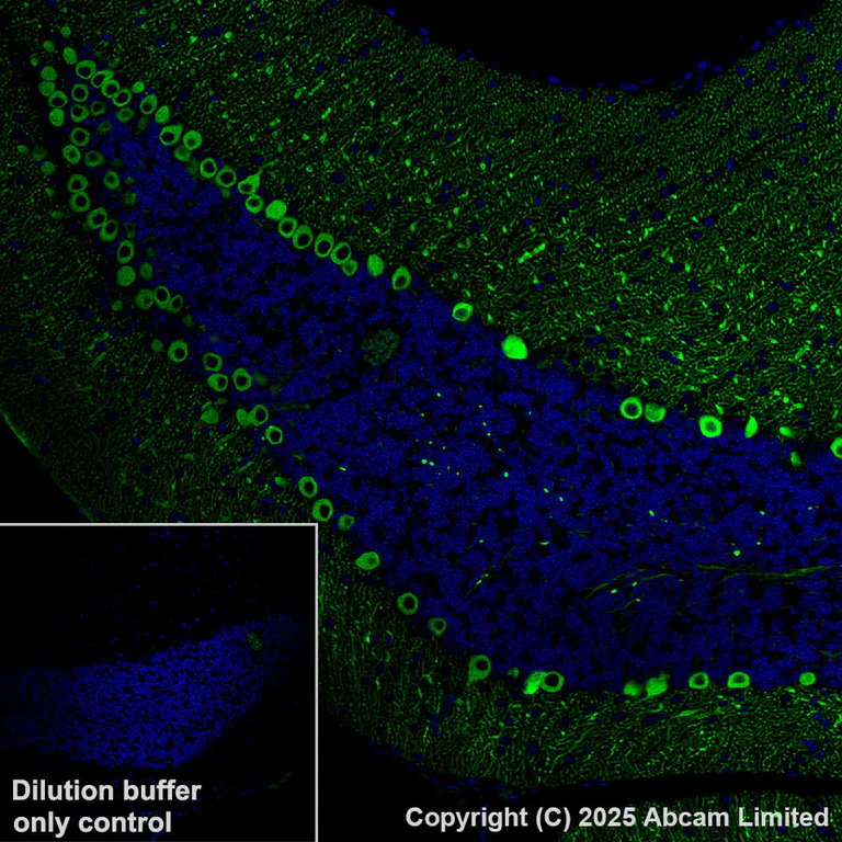 Immunohistochemistry (Formalin/PFA-fixed paraffin-embedded sections) - Alexa Fluor® 488 Anti-Carbonic Anhydrase 8/CA8 antibody [EPR29175-67] (AB324297)