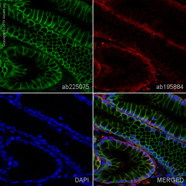 Immunohistochemistry (Formalin/PFA-fixed paraffin-embedded sections) - Alexa Fluor® 488 Anti-Carbonic Anhydrase 9/CA9 antibody [EPR4151(2)] (AB225075)