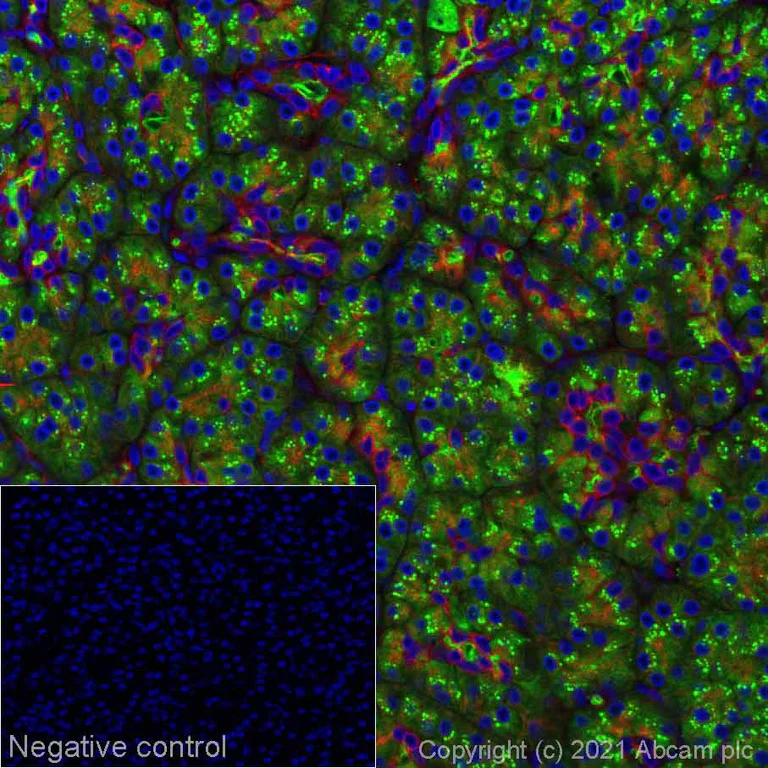 Immunohistochemistry (Formalin/PFA-fixed paraffin-embedded sections) - Alexa Fluor® 488 Anti-Carboxypeptidase A antibody [EPR24384-69] (AB282670)