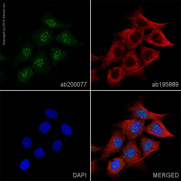 Immunocytochemistry/ Immunofluorescence - Alexa Fluor® 488 Anti-Caspase-14 antibody [EPR12927] (AB200077)