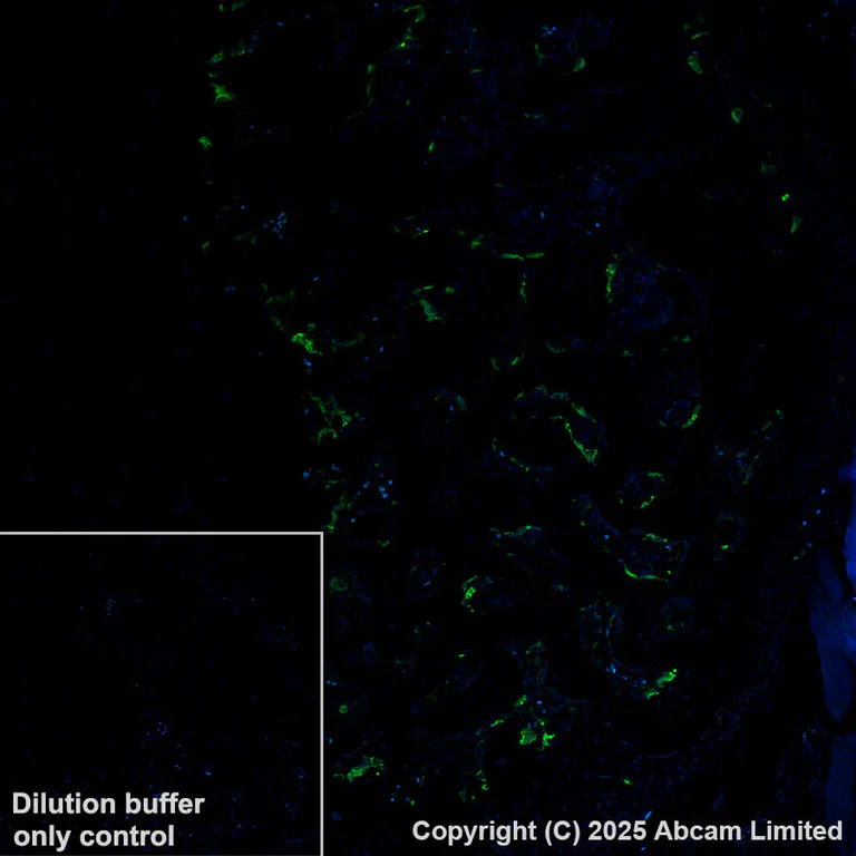 Immunohistochemistry (Formalin/PFA-fixed paraffin-embedded sections) - Alexa Fluor® 488 Anti-Cathepsin K antibody [EPR24829-101] (AB324070)