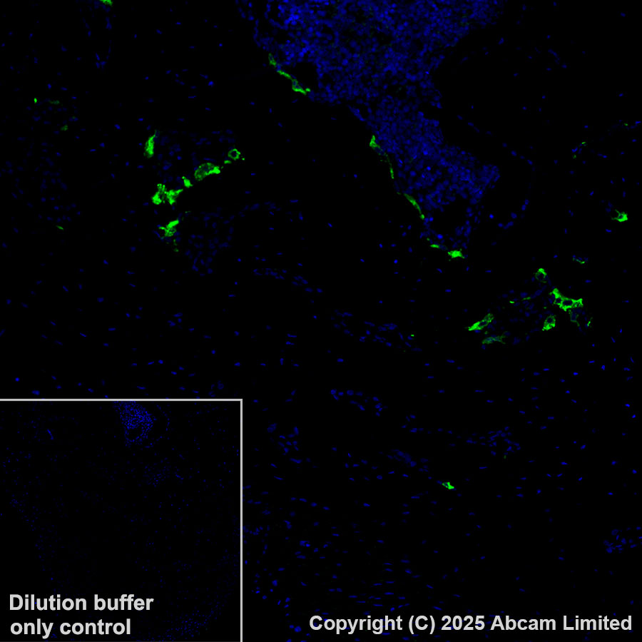 Immunohistochemistry (Formalin/PFA-fixed paraffin-embedded sections) - Alexa Fluor® 488 Anti-Cathepsin K antibody [EPR24829-101] (AB324070), expandable thumbnail
