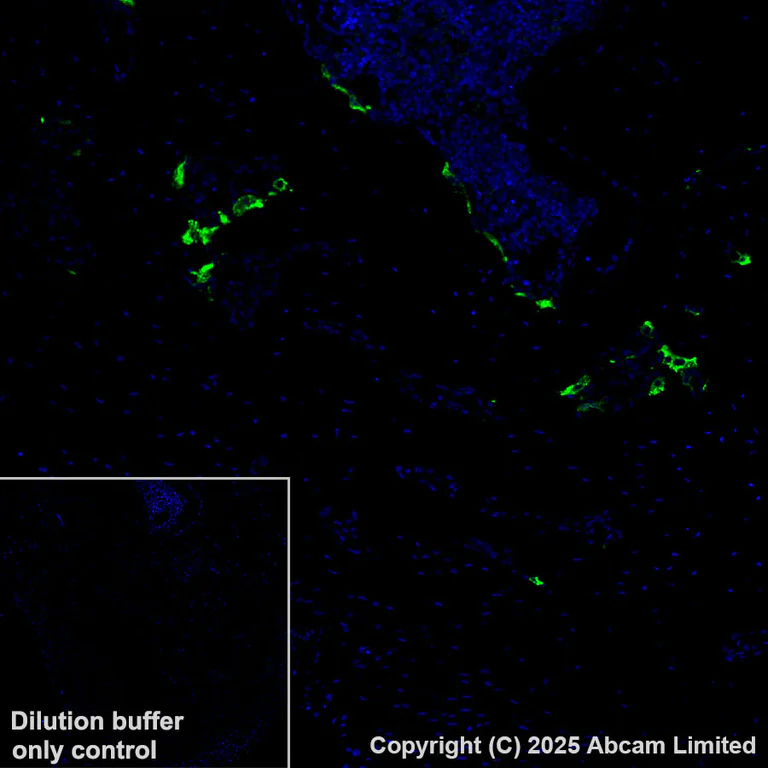 Immunohistochemistry (Formalin/PFA-fixed paraffin-embedded sections) - Alexa Fluor® 488 Anti-Cathepsin K antibody [EPR24829-101] (AB324070)