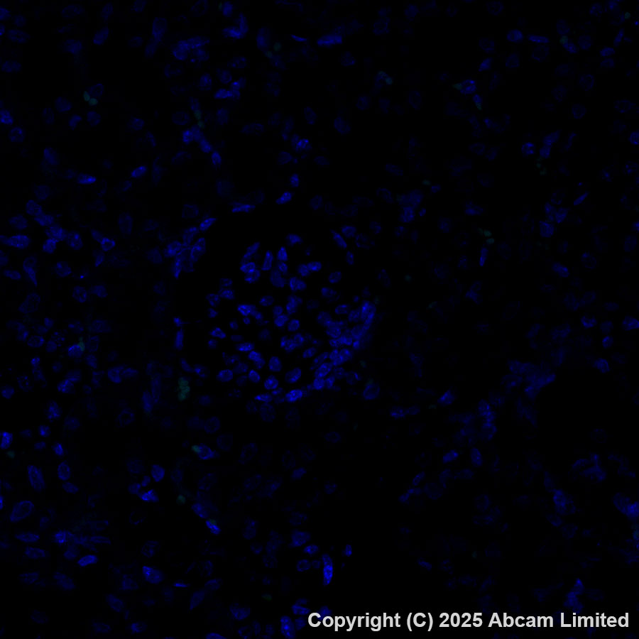 Immunohistochemistry (Formalin/PFA-fixed paraffin-embedded sections) - Alexa Fluor® 488 Anti-Cathepsin K antibody [EPR24829-101] (AB324070), expandable thumbnail