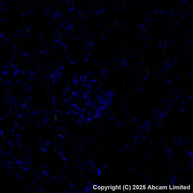 Immunohistochemistry (Formalin/PFA-fixed paraffin-embedded sections) - Alexa Fluor® 488 Anti-Cathepsin K antibody [EPR24829-101] (AB324070)