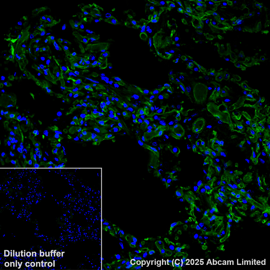 Immunohistochemistry (Formalin/PFA-fixed paraffin-embedded sections) - Alexa Fluor® 488 Anti-Caveolin-1 antibody [E249] - Caveolae Marker (AB185043)
