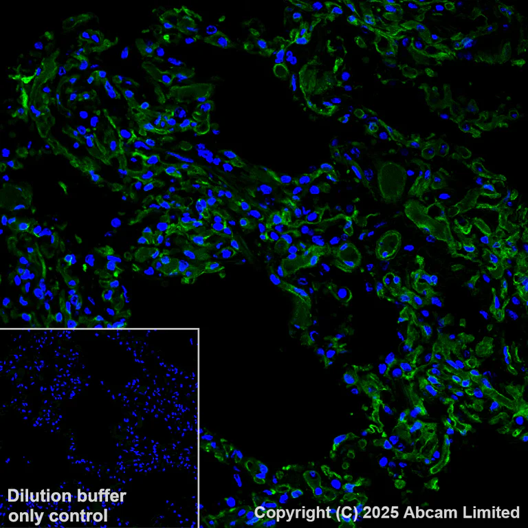 Immunohistochemistry (Formalin/PFA-fixed paraffin-embedded sections) - Alexa Fluor® 488 Anti-Caveolin-1 antibody [E249] - Caveolae Marker (AB185043)