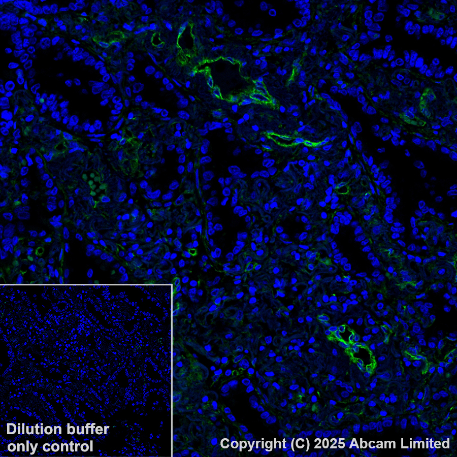 Immunohistochemistry (Formalin/PFA-fixed paraffin-embedded sections) - Alexa Fluor® 488 Anti-Caveolin-1 antibody [E249] - Caveolae Marker (AB185043)