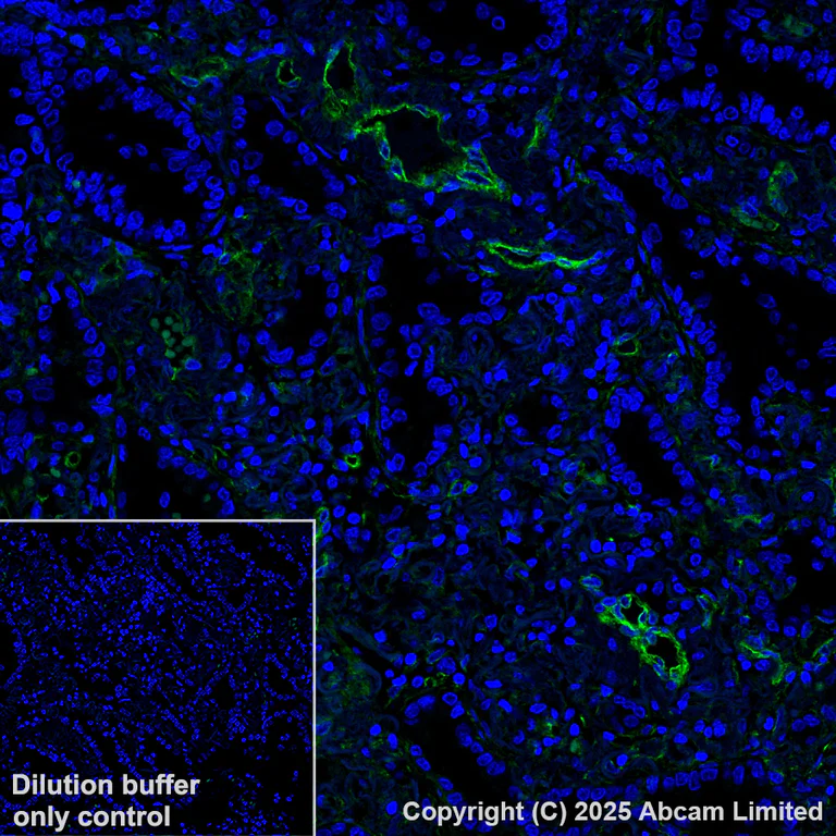 Immunohistochemistry (Formalin/PFA-fixed paraffin-embedded sections) - Alexa Fluor® 488 Anti-Caveolin-1 antibody [E249] - Caveolae Marker (AB185043)
