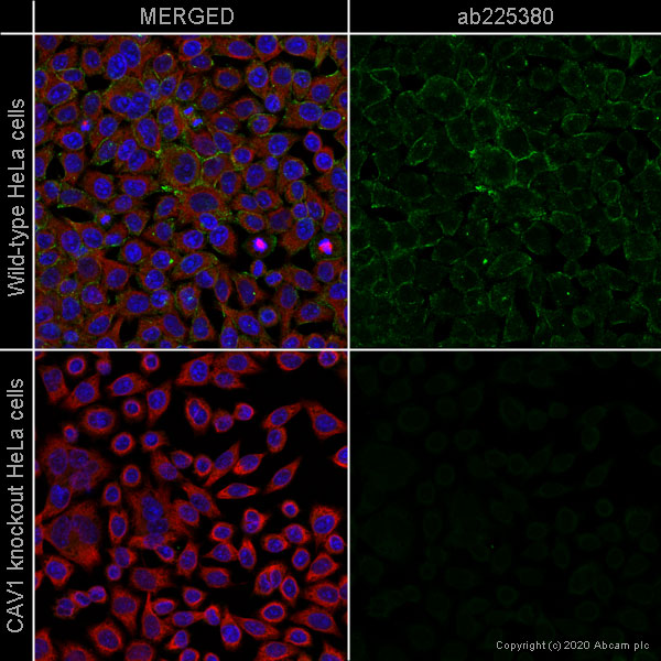 Immunocytochemistry/ Immunofluorescence - Alexa Fluor® 488 Anti-Caveolin-1 antibody [EPR15554] - N-terminal - Caveolae Marker (AB225380), expandable thumbnail