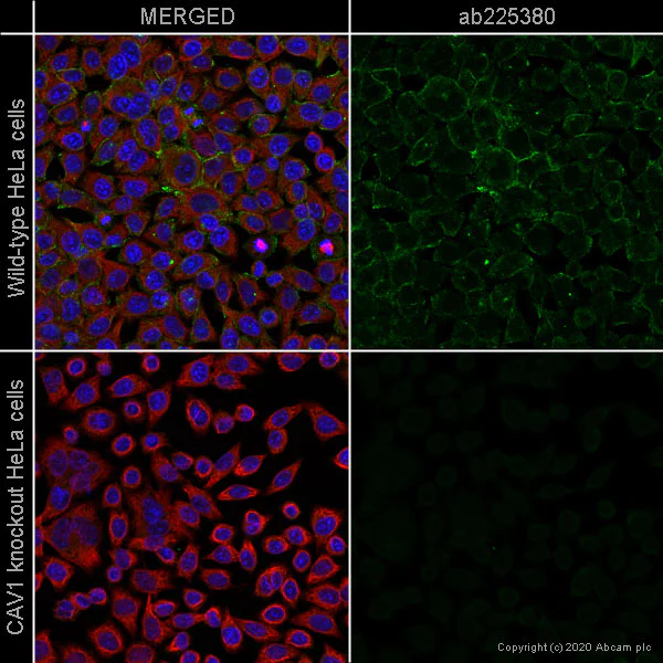 Immunocytochemistry/ Immunofluorescence - Alexa Fluor® 488 Anti-Caveolin-1 antibody [EPR15554] - N-terminal - Caveolae Marker (AB225380)