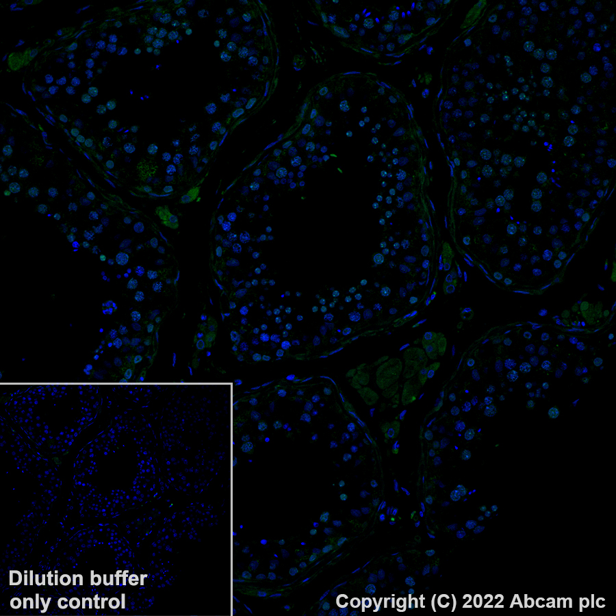Immunohistochemistry (Formalin/PFA-fixed paraffin-embedded sections) - Alexa Fluor® 488 Anti-CBX1 / HP1 beta antibody [EPR24242-78] (AB307384), expandable thumbnail