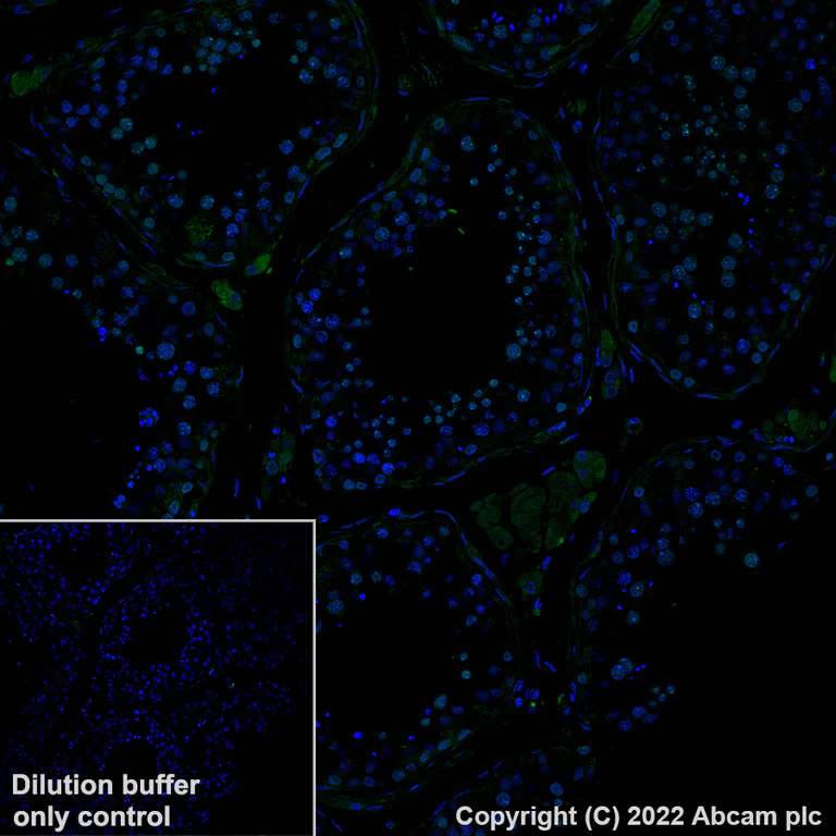 Immunohistochemistry (Formalin/PFA-fixed paraffin-embedded sections) - Alexa Fluor® 488 Anti-CBX1 / HP1 beta antibody [EPR24242-78] (AB307384)