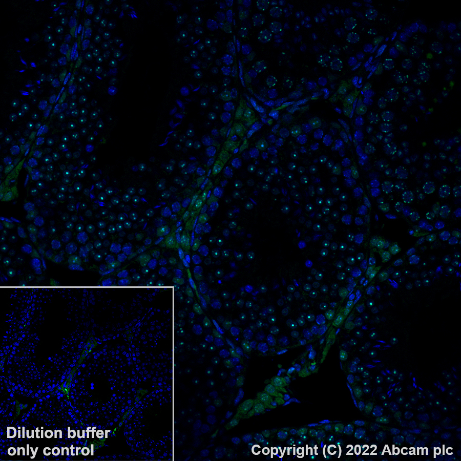 Immunohistochemistry (Formalin/PFA-fixed paraffin-embedded sections) - Alexa Fluor® 488 Anti-CBX1 / HP1 beta antibody [EPR24242-78] (AB307384), expandable thumbnail