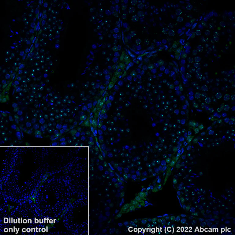 Immunohistochemistry (Formalin/PFA-fixed paraffin-embedded sections) - Alexa Fluor® 488 Anti-CBX1 / HP1 beta antibody [EPR24242-78] (AB307384)