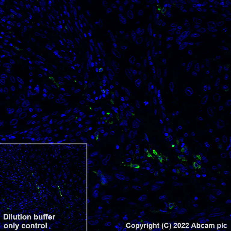 Immunohistochemistry (Formalin/PFA-fixed paraffin-embedded sections) - Alexa Fluor® 488 Anti-CCL18 antibody [EPR24781-84] (AB307628)