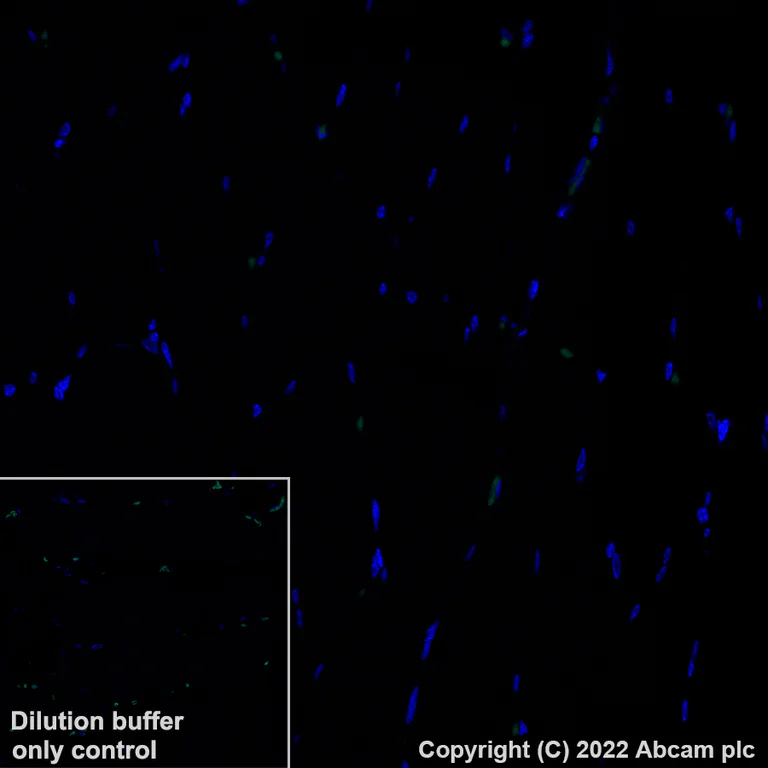 Immunohistochemistry (Formalin/PFA-fixed paraffin-embedded sections) - Alexa Fluor® 488 Anti-CCL18 antibody [EPR24781-84] (AB307628)