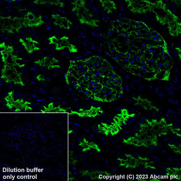 Immunohistochemistry (Formalin/PFA-fixed paraffin-embedded sections) - Alexa Fluor® 488 Anti-CD10 antibody [EPR22867-118] (AB308601)